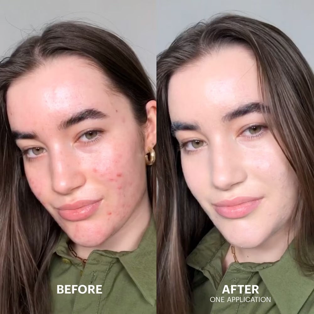 Cicapair Tiger grass color correcting treatment